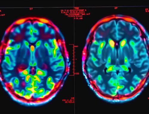 New MRI Study Reveals How Cannabis Alters Brain Activity and Weakens Memory