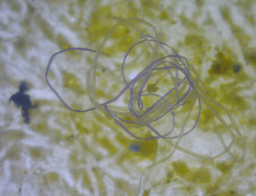 Tiny Terrors: Microplastics’ Threat to Our Health and Environment