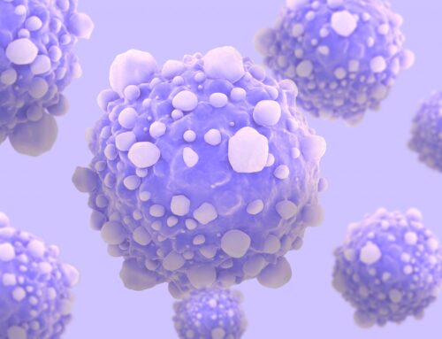 Pancreatic Cancer Cells Rely on Acidic Environment to Survive