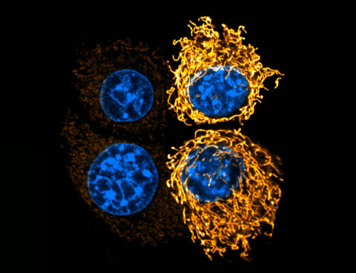 Acidic tumor environment promotes survival and growth of pancreatic cancer cells, study sh