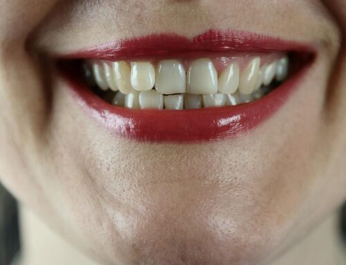 Hey New Yorkers, Let’s Talk About Weed and Your Teeth
