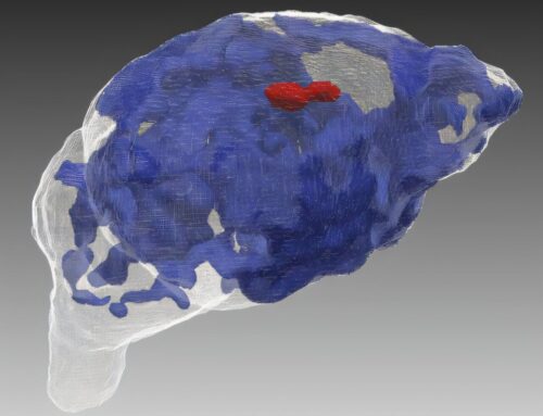 Heavy cannabis use during pregnancy linked to disruption in brain growth