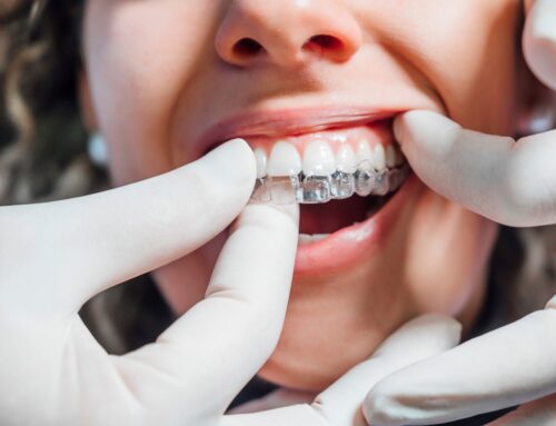 What affects the environment more: aligners or braces?