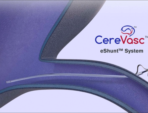 CereVasc closes $85M Series C to support eShunt system with investment from J&J, Medtronic